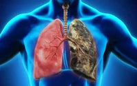 Thumbnail for Herbal Health Drops: Lung Support Cleanse & Respiratory