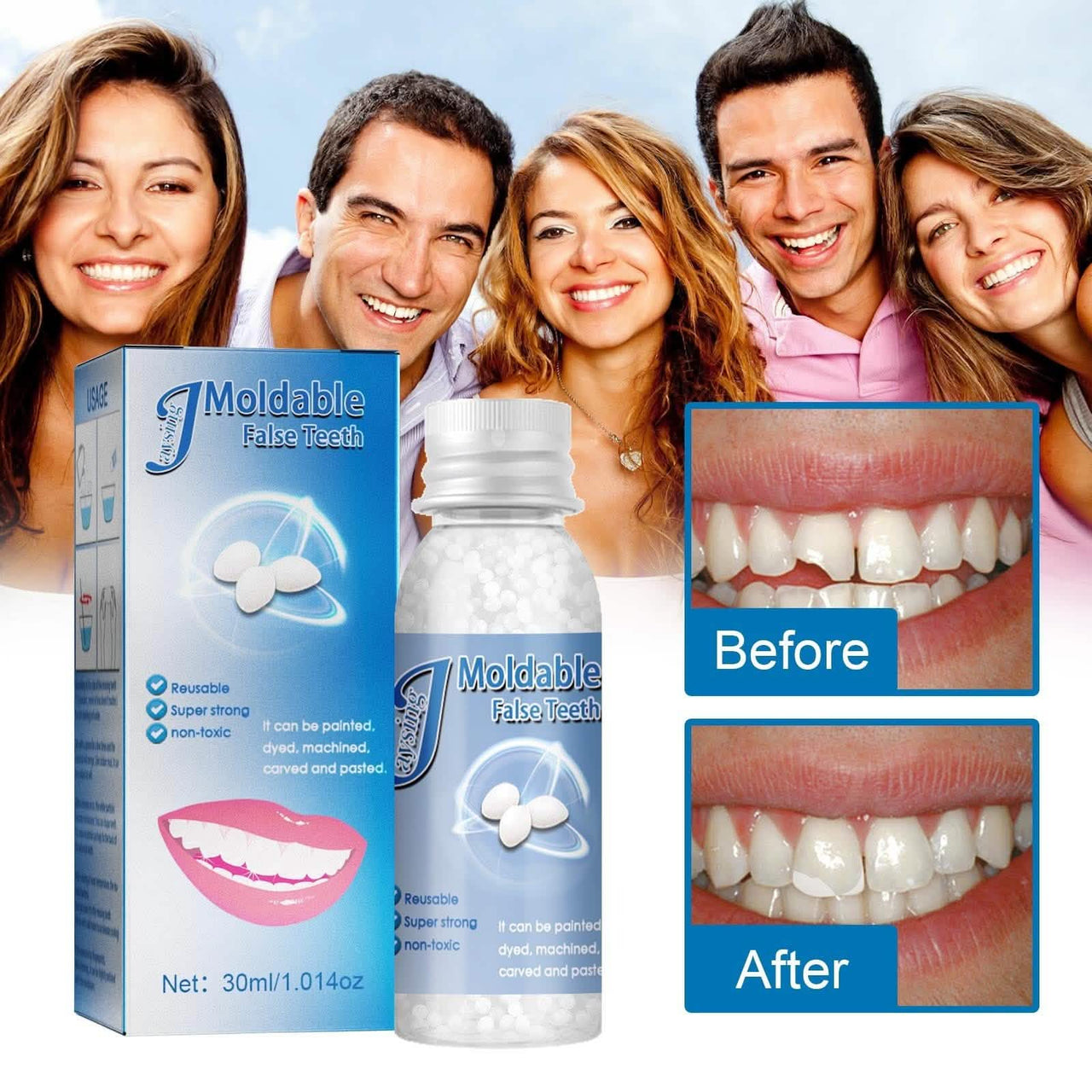 Temporary Moldable Broken Teeth Gaps Filling (Buy 1 Get 1 Free)